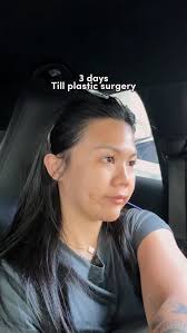 Sooooo I went to Korea to get my double chin removed, did a fox line  lifting, threading and got my Biccol fat removed, to have the more define  face!, You guys wanna know the whole journey?!? Let me ...