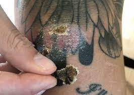 Check spelling or type a new query. How Long Does It Take For A Tattoo To Heal 2021 Guide Healing Tattoo Tattoo Healing Process Tattoo Scabbing
