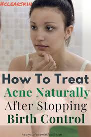 Treat Acne After Stopping Birth Control How To Heal Hormonal Acne Naturally Heal Your Face With Food How To Treat Acne Face Mapping Acne Treat Acne Naturally