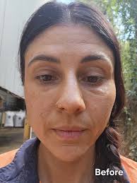 Any ideas for red and sore lumps