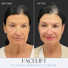 Plastic Surgery Center