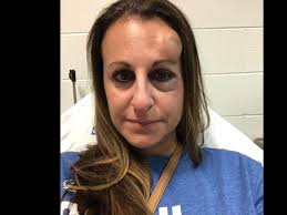 After getting hit by puck, Tampa mom wary about hockey games