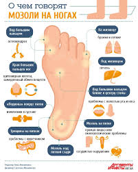 как избавиться от мозолей на пальцах ног народными средствами Pin By Lyubov Pankova On Zdorove Health Fitness Health And Beauty Beauty Health