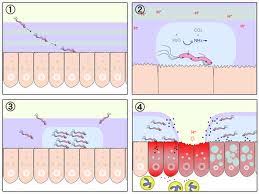 Its presence is associated with gastritis and there is substantial evidence that it causes peptic and duodenal ulcers and chronic gastritis. Helicobacter Pylori Tratament Si Reactii Adverse Hollie Smokes Another Blog