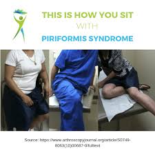 The condition is relatively common. Frustrated Piriformis Syndrome Treatment That Works When Your Pain Has Lasted Longer Than 6 Months