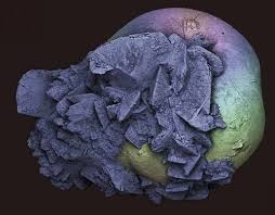 Scienceyoucanlove Kidney Stone Under Microscope Scanning Mind Blowing Images Kidney Stones Things Under A Microscope