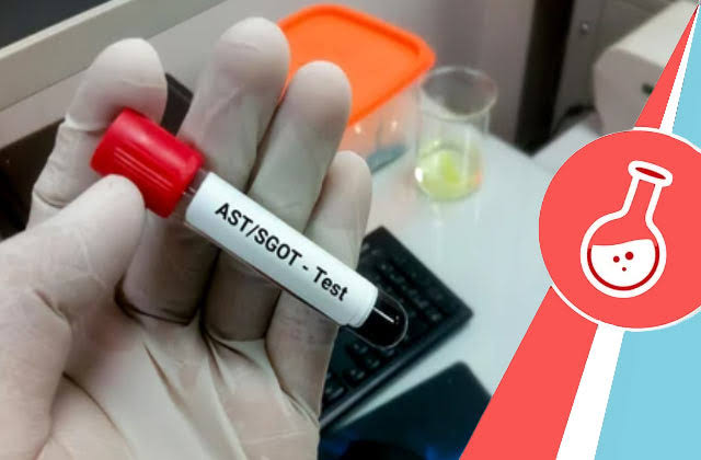 AST / SGOT product image