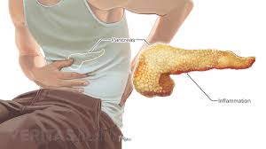 The lower gastrointestinal tract comprises the small intestine, large intestine and the anus. Lower Left Back Pain From Internal Organs