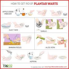 How To Get Rid Of Plantar Warts Top 10 Home Remedies Warts Plantar Wart Remedies How To Get Rid