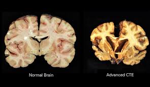 Book doctor appointment consult doctor online. Organic Brain Syndrome Wikipedia