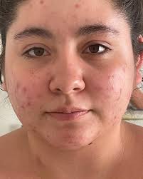 SG Aesthetics 🌻𝑺𝒂𝒎 𝑮𝒂𝒍𝒍𝒆𝒈𝒐𝒔🌻 (@sg_aestheticsbar) • Instagram  photos and videos