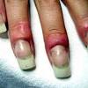 0.0.8 remove acrylic nails without using acetone. 1