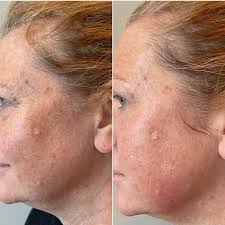 Angie Spence Skintherapy