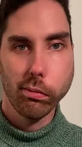 "I've not had a rude comment since wearing a face mask.", Atholl Mills has  cystic hygroma. The 26-year-old waiter says wearing a mask has helped him  deal with "stares and comments" about his facial ...