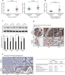 Leguminoasele, aproape toate soiurile de nuci şi soia. Association Of Dcbld2 Upregulation With Tumor Progression And Poor Survival In Colorectal Cancer Springerlink