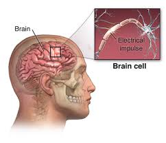 In someone with epilepsy, certain triggers can lead to a seizure. Evaluation Of A First Time Seizure Johns Hopkins Medicine