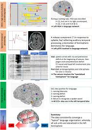 I corinthians chapter twelve begin with paul telling the corinthian church, and for the most part, all believers in the church today. Contributions Of Electrophysiology For Identifying Cortical Language Systems In Patients With Epilepsy Epilepsy Behavior