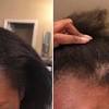 Change in color of hair. 1