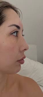 I've shortlisted a few doctors for Asian rhinoplasty, have you had any  experience with either of these? Dr. Enis Yalcin Dr. Saban Celebi Dr. Eren  Ersoz (mono clinic) Dr. Fahrettin Yilmaz Would