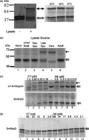 And extends from the second lumbar vertebra to the root of the neck. A Blood Fluke Serine Protease Inhibitor Regulates An Endogenous Larval Elastase Journal Of Biological Chemistry