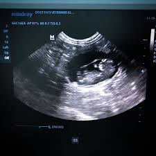 Dogum Takibi Kedi Ve Kopeklerde Cok Onemli Bebek Kedi Baby Kitten Babycat Ultrason Pati Body Celestial Bodies