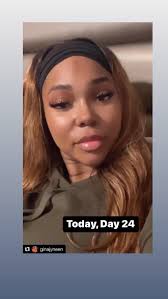 For those following Roger's story; this is Roger at his home 4 months  postop. Looking healthy and still healing. He has a new lease