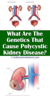 Below is a broad spectrum of important signs and symptoms common to a variety of illnesses, diseases, and cancers. Pin On What Is Kidney Disease