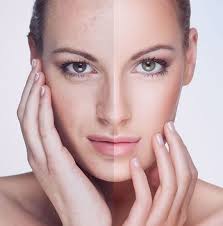 Laser Hair Removal & Laser Skin Treatments in Manning, SC