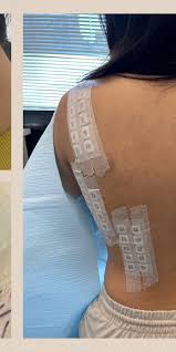 Image result for Patch Testing