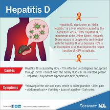 Modern algorithm of diagnostics and treatment. Wockhardt Hospitals On Twitter Hepatitis D Also Known As The Hepatitis Delta Virus Is An Infection That Causes The Liver To Become Inflamed This Swelling Can Impair Liver Function And Cause Long Term