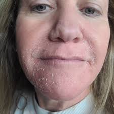 Tara Hinkle (@celestial_esthetics_skincare) · Lakewood, CO