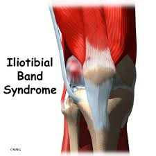 Individual throttle body, a throttle unit for an engine cylinder. Iliotibial Band Syndrome