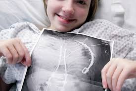 Hope Fuglesten, 12, battles spina bifida