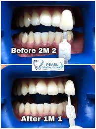 Check spelling or type a new query. Cara Cara Penjagaan Klinik Pergigian Pearl Johor Bahru Facebook