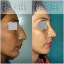 Dr. Javier Briones Iglesias