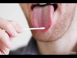 What are the symptoms of swollen taste buds. How To Dull Your Taste Buds Youtube