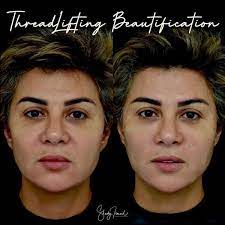 Maybe you would like to learn more about one of these? Ø¨Ø§Ù„ØµÙˆØ± Ù…ÙÙŠØ¯Ø© Ø´ÙŠØ­Ø© Ø¨Ø¹Ø¯ Ø¹Ù…Ù„ÙŠØ© Ø§Ù„ØªØ¬Ù…ÙŠÙ„ ÙÙŠ ÙˆØ¬Ù‡Ù‡Ø§ Ø§Ù„Ø¬Ù…Ø§Ù„ Ù†Øª