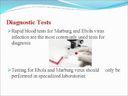 A severe viral hemorrhagic fever. Ebola Virus Disease Arun Malik 1 Navjot Kaur