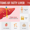 Some of the early warning signs of liver cancer include liver cancer, also known as hepatic cancer, is a type of cancer that starts in the liver. 1