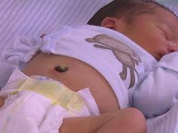 You should take extra care of the umbilical cord while giving a sponge bath and keep it dry always. How To Care For Your Newborn S Umbilical Cord Stump Video Babycenter