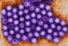 Globally, norovirus kills 200,000 people a year. Norovirus Easy To Catch Hard To Get Rid Of
