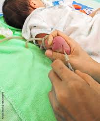 Image result for Infant Blood Sample