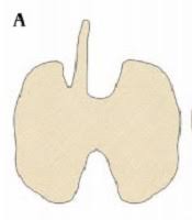 Check spelling or type a new query. Ultrasonographic Evaluation Of The Pyramidal Lobe Of The Thyroid Gland In Infants And Children In Western Turkey Between 2018 And 2020 Iranian Journal Of Radiology Full Text
