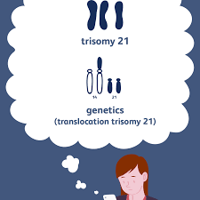 Down Syndrome Causes And Risk Factors