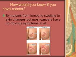Breast or ovarian cancer risk isn't just passed from mother to daughter or son. Breast Cancer