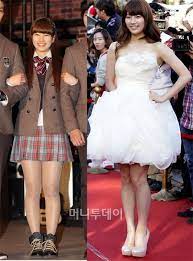 Before and after alleged plastic surgery 1. Miss A Suzy S Before And After Diet Photos Miss A Suzy Bae Suzy Suzy