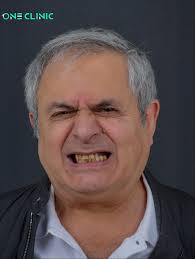 Transforming Smiles, Transforming Confidence! ✨ We're excited to share the  incredible smile journey of our dear patient Milena Boyanova Ralcheva ❤️  Her beautiful transformation reflects trust, care, and the expertise we  proudly