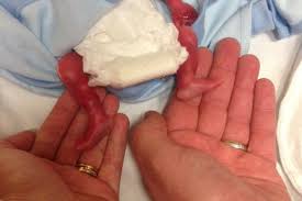 But baby isn't just getting bigger, they're also getting smarter. Heartbreaking Photo Captures Couple S Goodbye To Son Born Asleep At 27 Weeks Mirror Online
