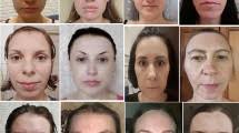 Assessing Facial Symmetry and Attractiveness using Augmented Reality