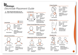 43 Disclosed Tens Electrode Placement Chart Pdf